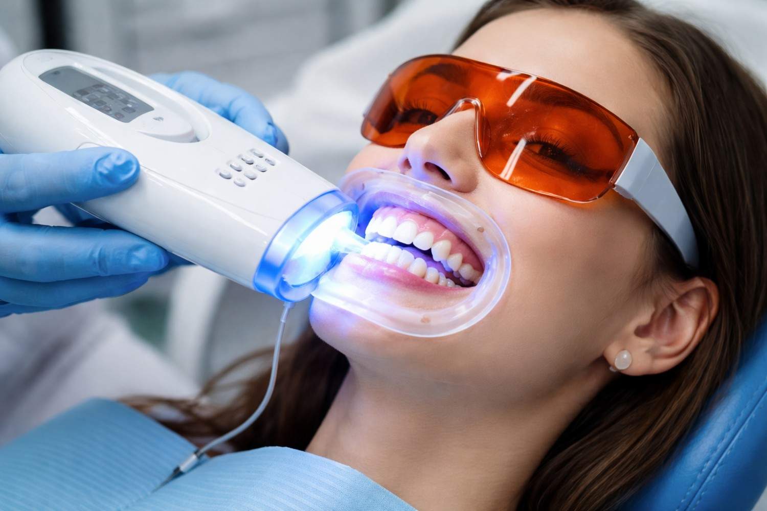 Teeth Whitening – Benefits, Uses, and Why It Matters